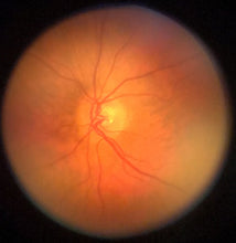 Load image into Gallery viewer, oDocs nun ophthalmoscope retinal camera